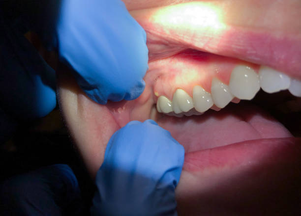 Best After-Hours Emergency Dentist in Dewitt, MI