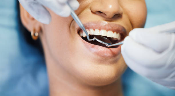 Best Emergency Tooth Extraction in Dewitt, MI