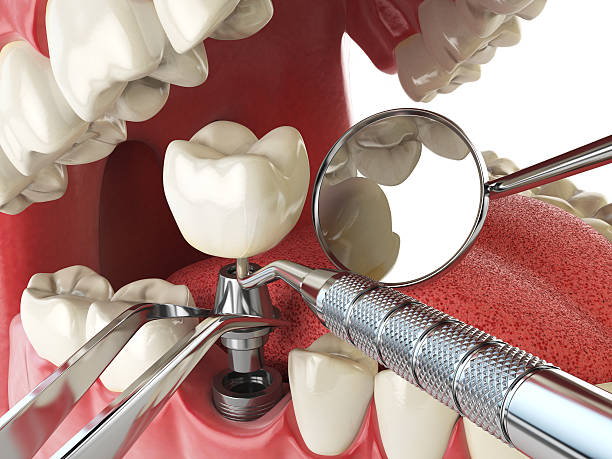 Best Emergency Orthodontic Repairs in Dewitt, MI